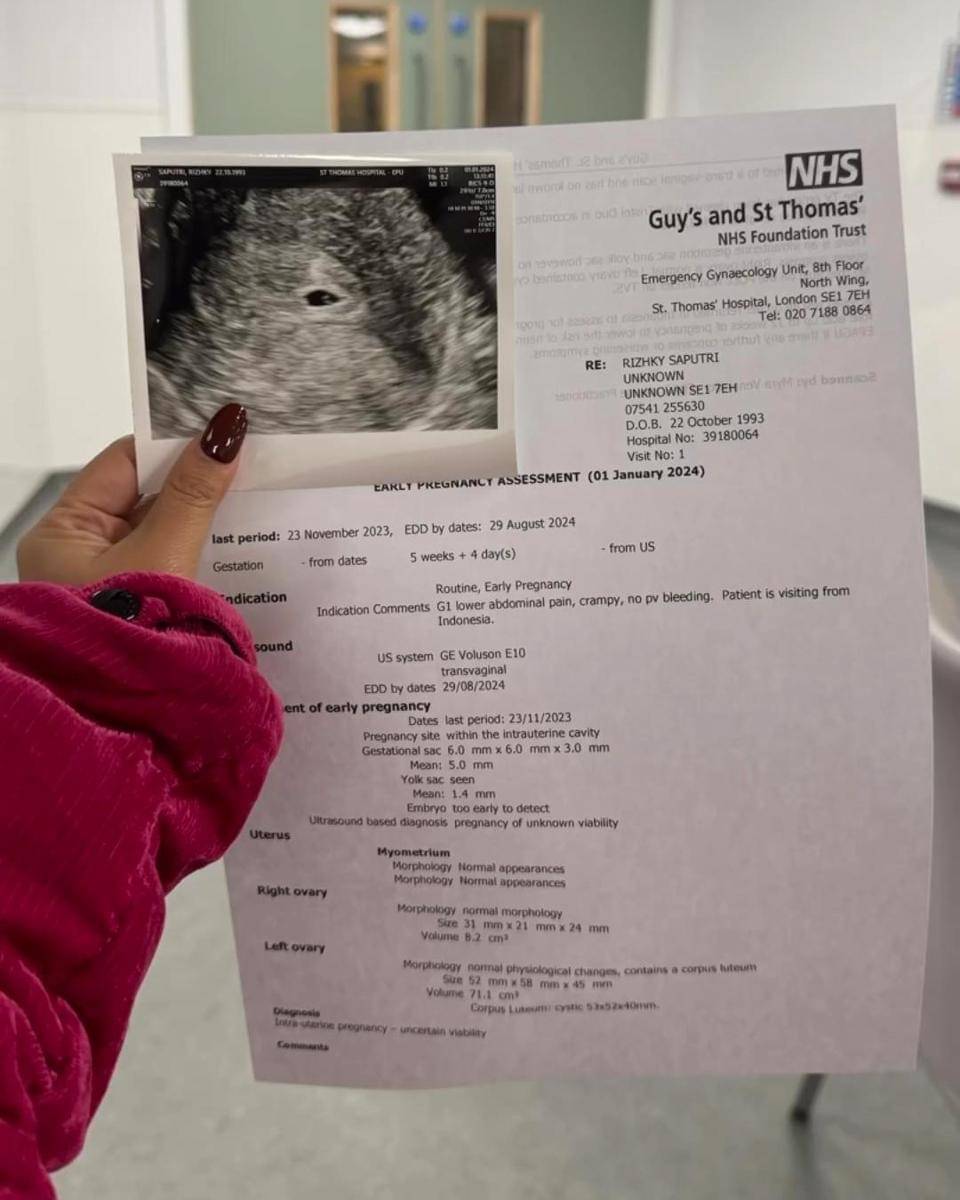 Instagram.com/kikysaputrii